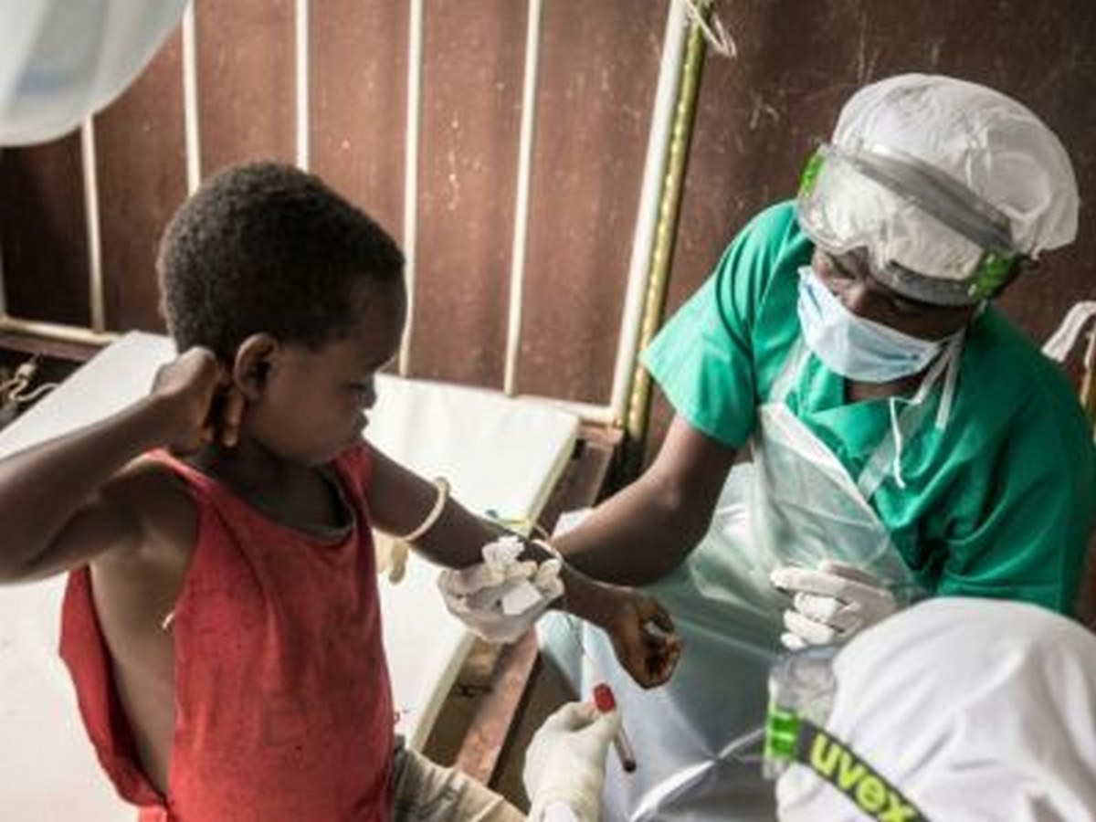 Monkey pox: a suspected case in Haiti